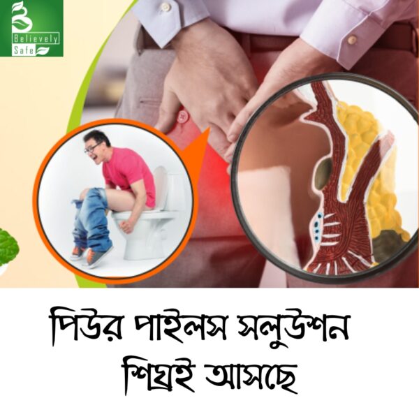 পাইলস সলুউশন | Pails Solution